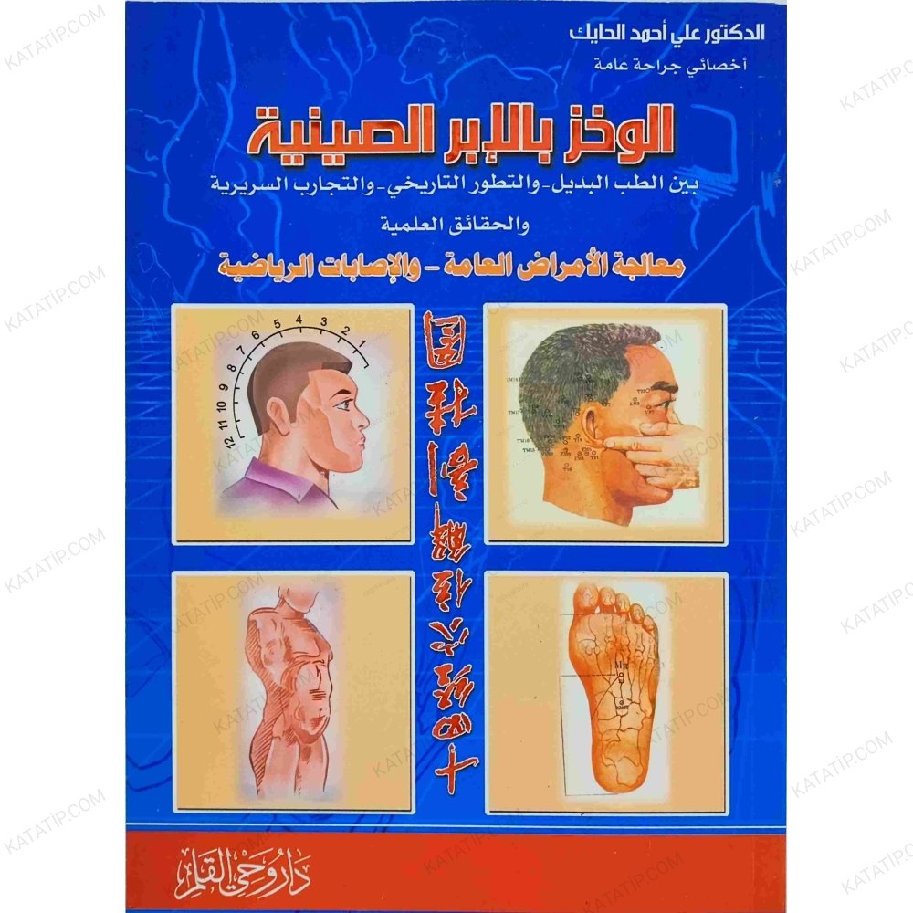 الوخز بالابر الصينية
