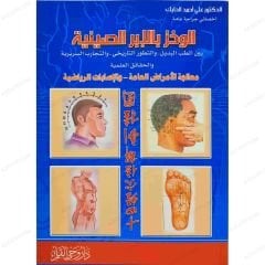 الوخز بالابر الصينية